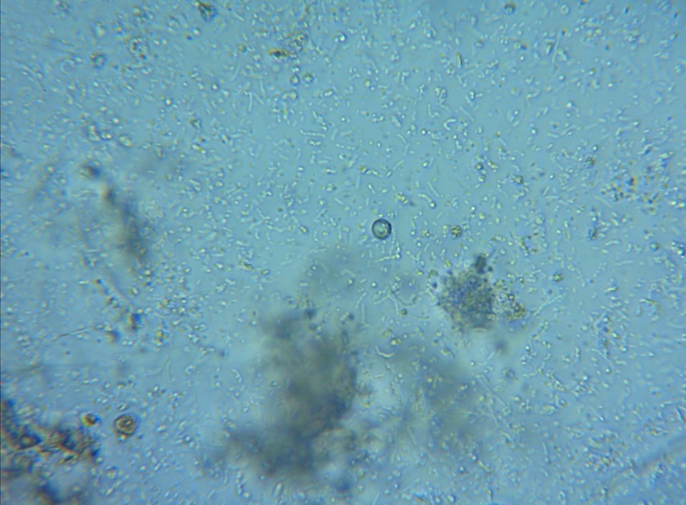 A microscope slide of the control effluent (no added yeast), showing growth of unwanted organisms.