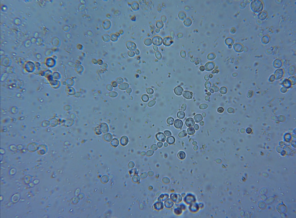 A microscope slide of the effluent with added yeast, showing multiple stages of yeast development. 